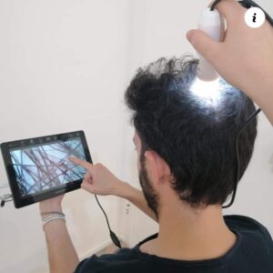 Consulenza Tricologica