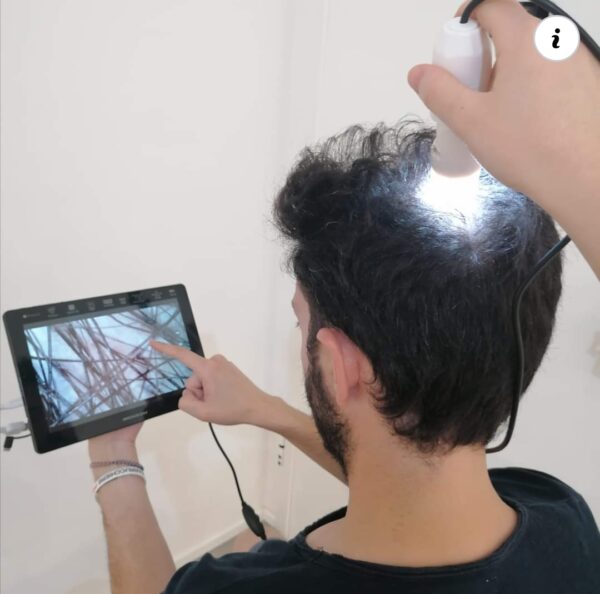Consulenza Tricologica